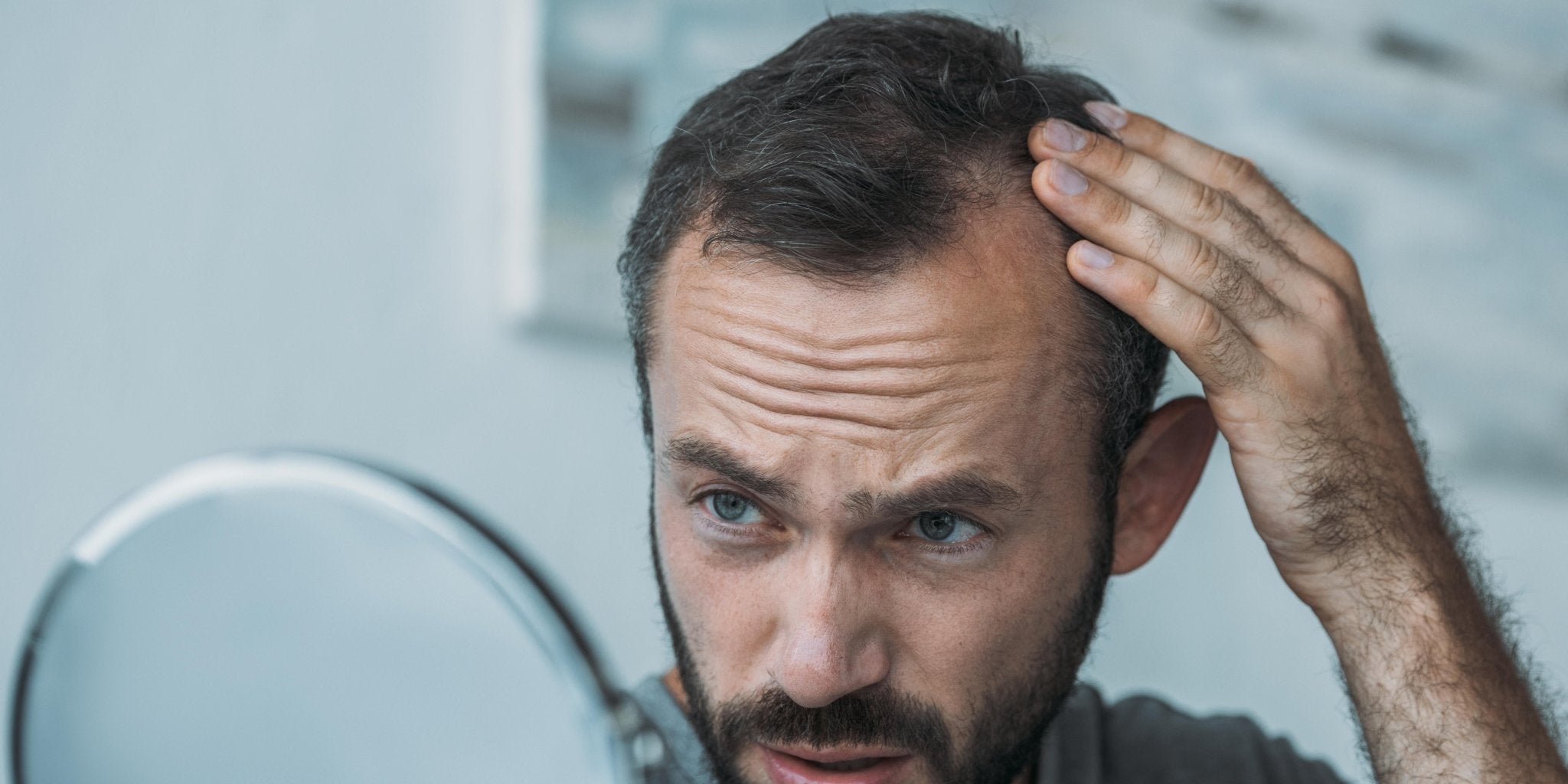 ¿Estás perdiendo Cabello o Barba mientras usas Minoxidil? - BarbaReal