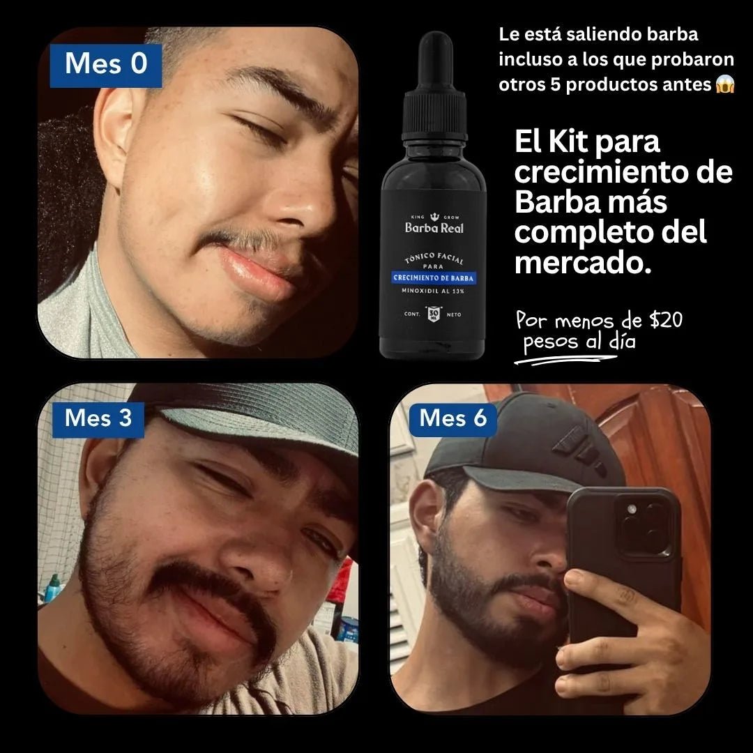 Kit 6 Minoxidil al 13% - BarbaReal