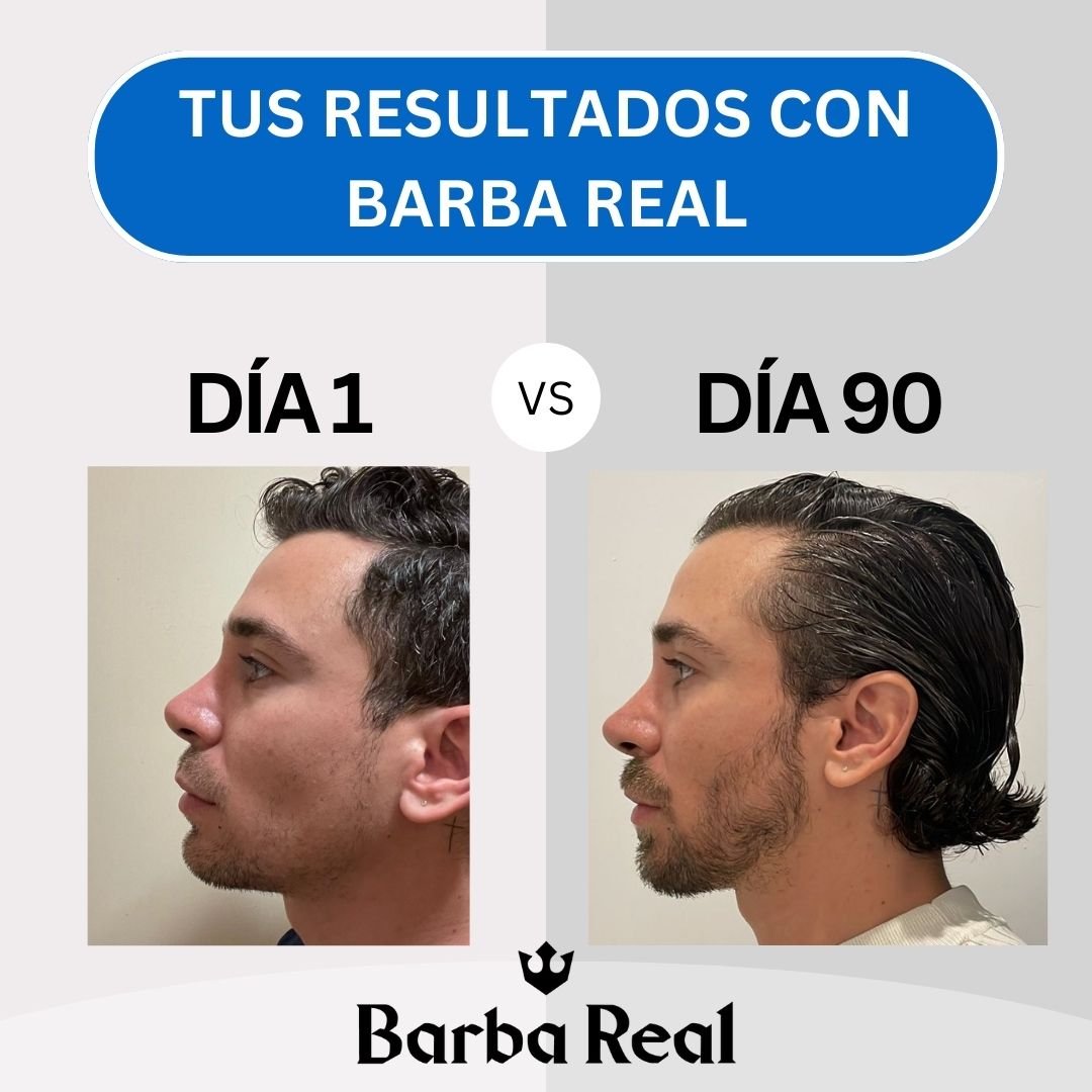 Kit 6 Minoxidil al 13% - BarbaReal