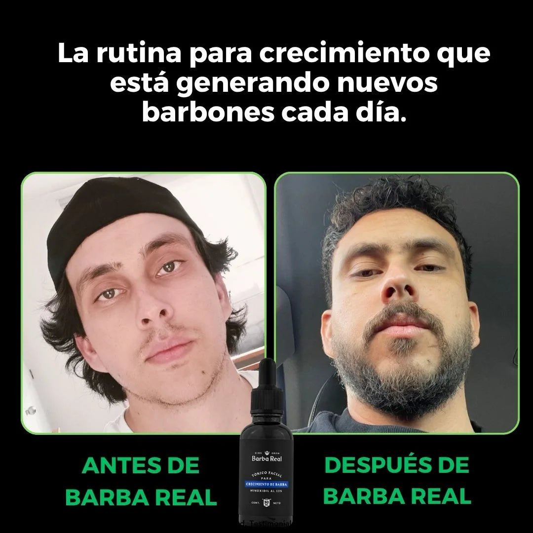 Kit 6 Minoxidil al 13% - BarbaReal