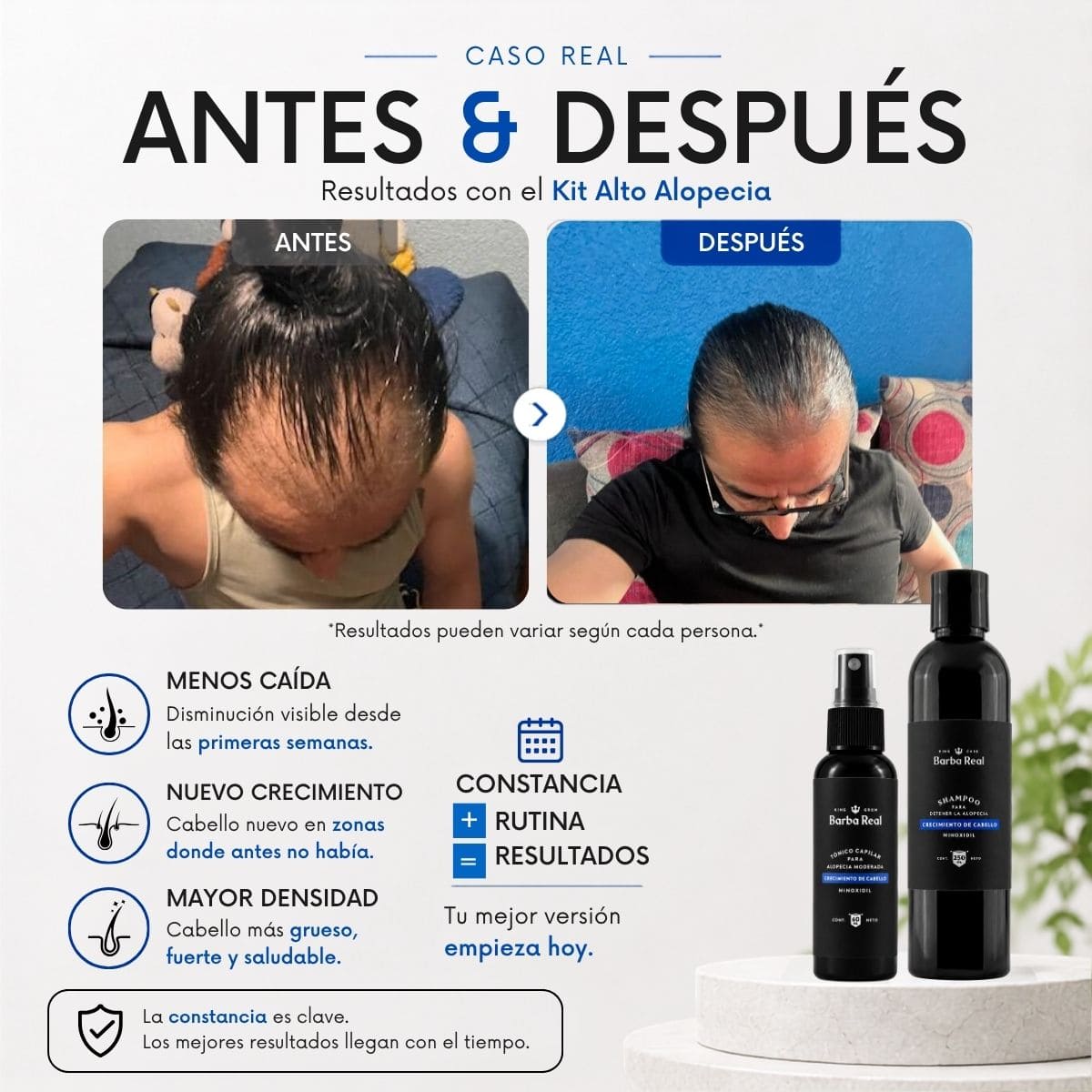 Kit alto alopecia | Detiene la caída y Recupera el cabello. - BarbaReal