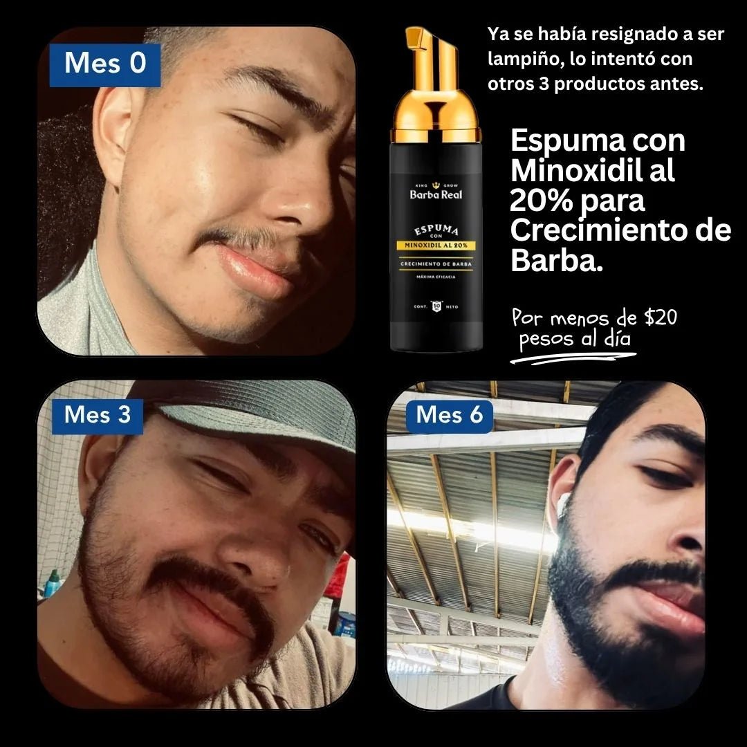 Kit Barba Real - Minoxidil al 20% +Biotina y Derma - BarbaReal