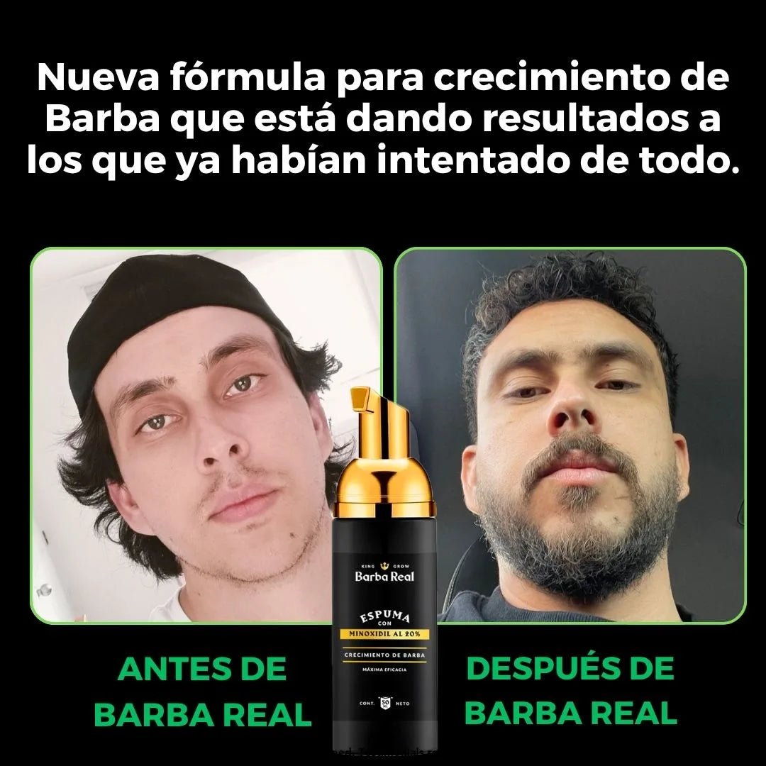 Kit Barba Real - Minoxidil al 20% +Biotina y Derma - BarbaReal