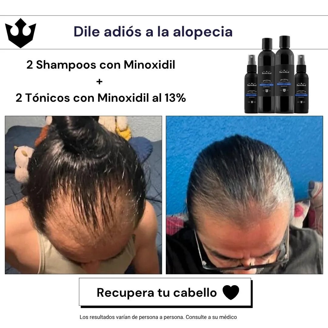 Pack Barba y Cabello - BarbaReal