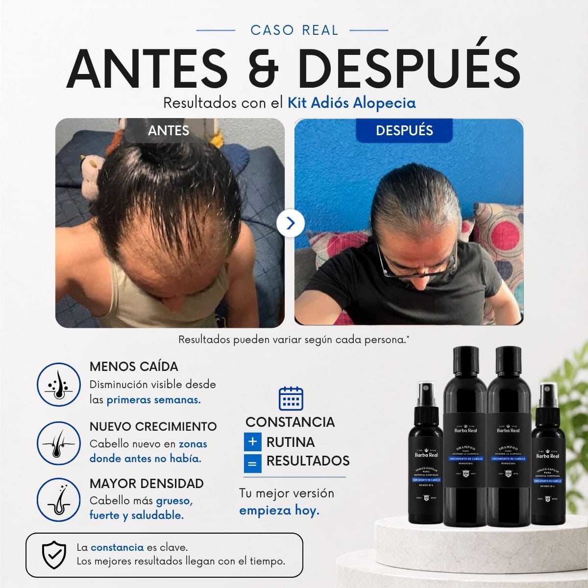 Kit Adiós Alopecia | Detiene la caída y Recupera el cabello. - BarbaReal