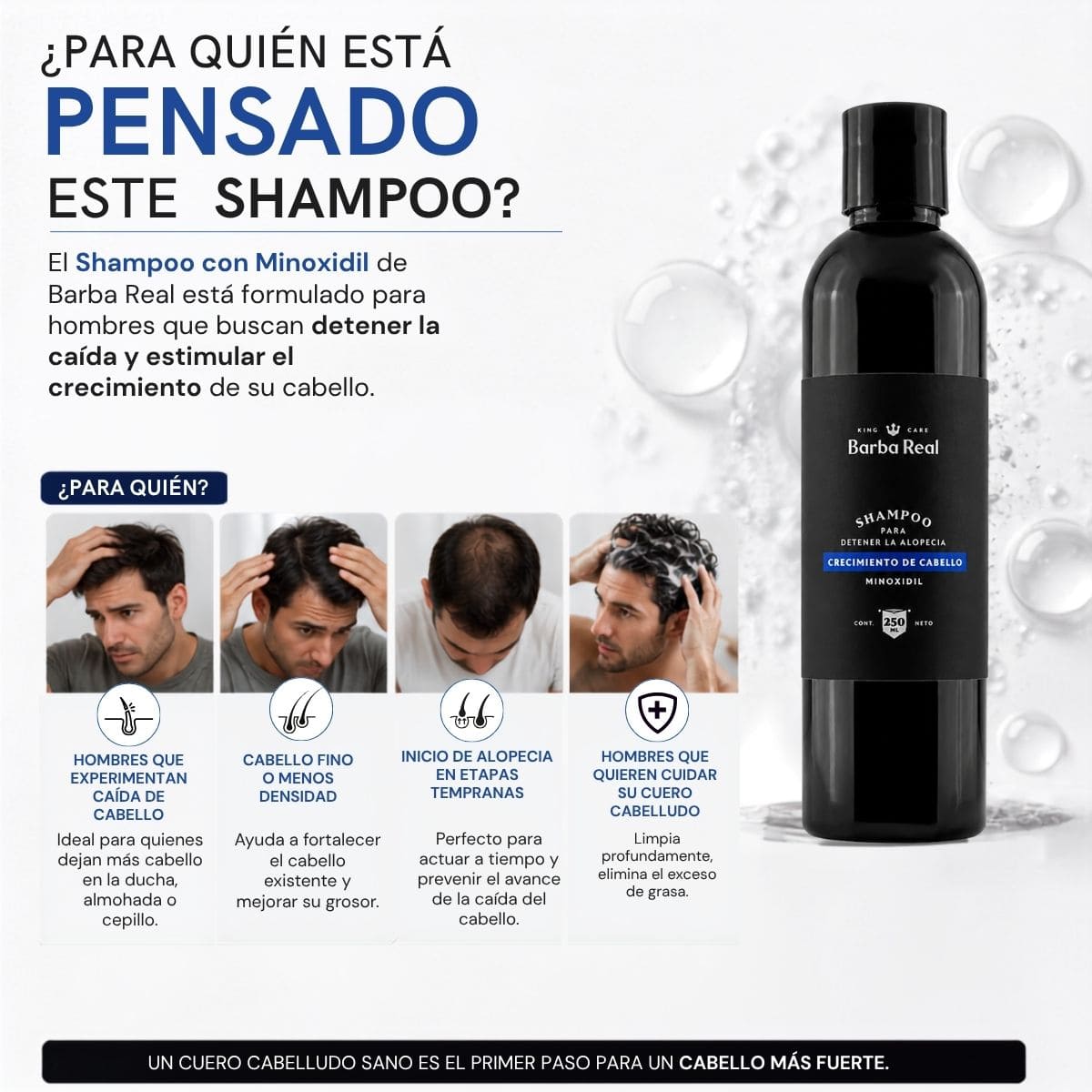 Shampoo con Minoxidil | Fortalece el cabello y detiene la caída - BarbaReal